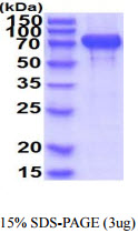 3 μg by SDS-PAGE under reducing condition and visualized by coomassie blue stain.